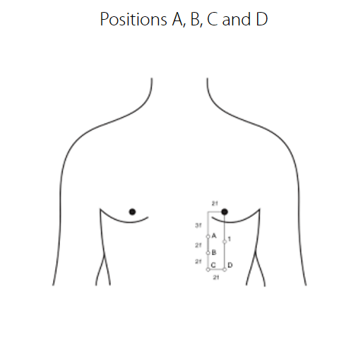 Points A and B